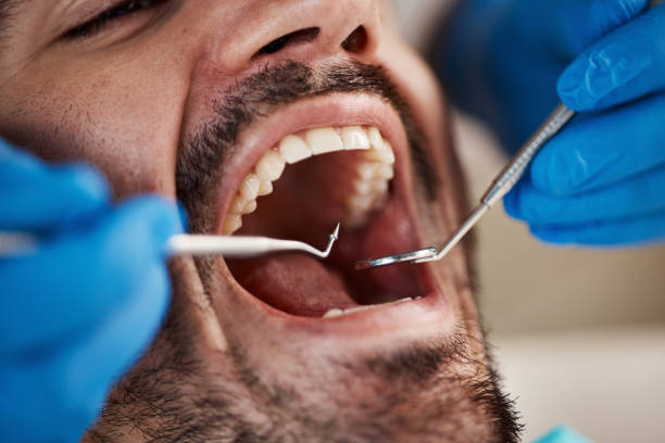 Best Emergency Denture Repair in Yerington, NV